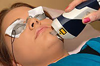 Laser Acne Treatment for Severe Acne Cases
